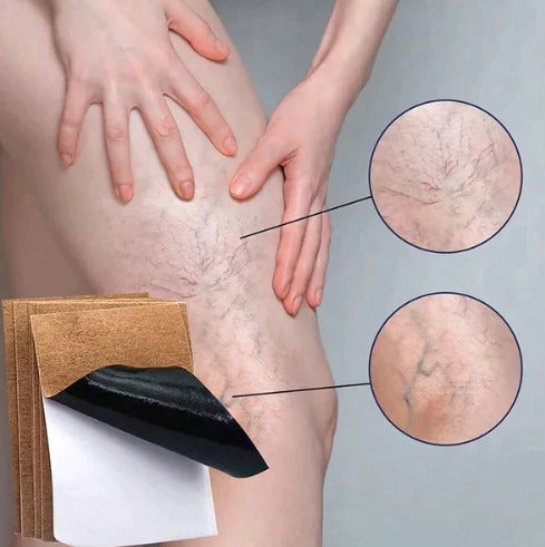 VeinsCare™ PACK 3X1🎁 PARCHES PARA VÁRICES (36 UND)