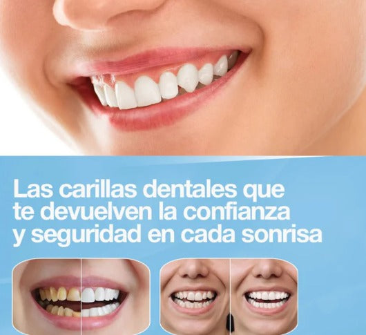 Carillas Dentales™ - PACK 2X1